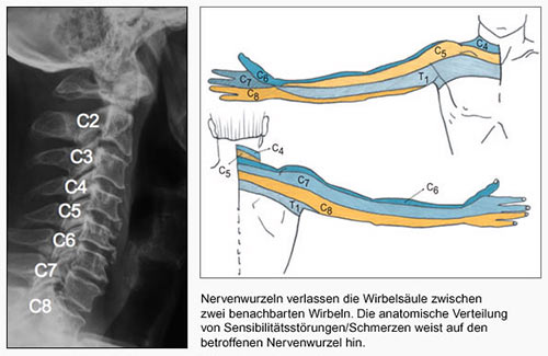 Halswirbelsäule Projektion